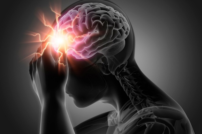 טיפול טבעי במיגרנות וכאבי ראש באמצעות CBD